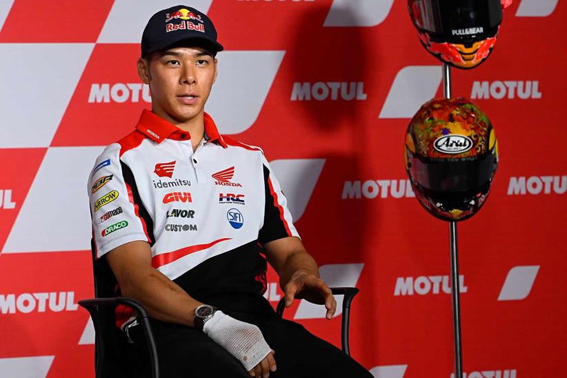 Takaaki Nakagami seen with his bandaged hand in Japan