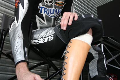 Garry McCoy rode in Qatar with a broken leg