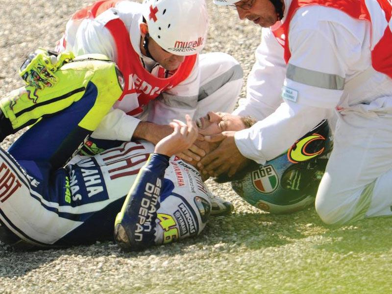 Rossi second operation on broken leg MCN